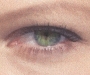 HP Eye NormalClose